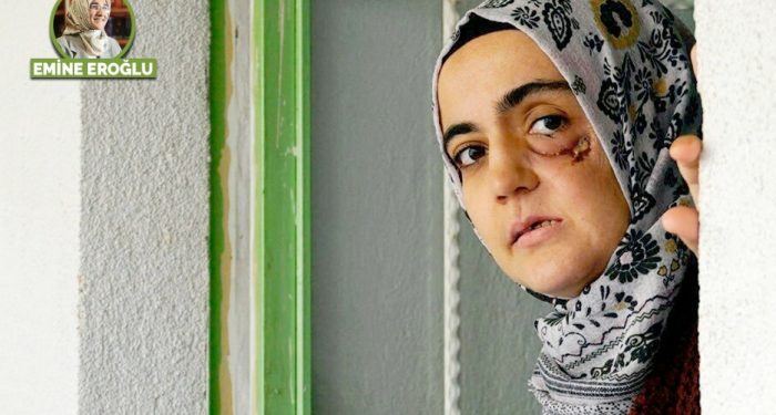 Utanmayanların, toplumun diğer kesimlerinin ve tarihin sırtına yükledikleri büyük kambur