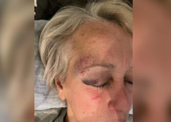 Çiğdem Köksal Schmidt Urfa’da saldırıya uğradı