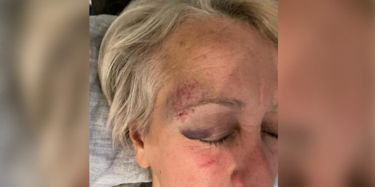 Çiğdem Köksal Schmidt Urfa’da saldırıya uğradı