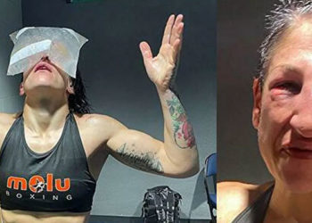 237 yumruk yiyen boksör, maç sonunda tanınmaz hale geldi