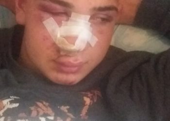 Ankara’da ırkçı saldırı: Pis Kürtler, burası size mezar olacak