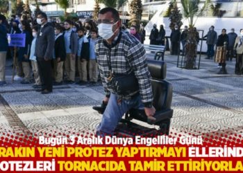 "Bırakın yeni protez yaptırmayı ellerindeki protezleri tornacıda tamir ettiriyorlar"