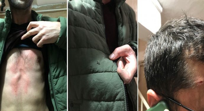 HDP binasına silahlı ve bıçaklı saldırı: İki partili yaralandı, saldırgan yakalandı