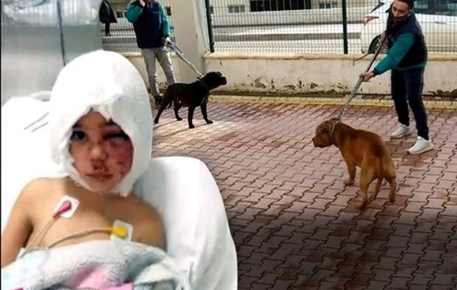 Pitbull saldırısına uğrayan Asiye’nin babasını, köpeklerin sahibi işten attı