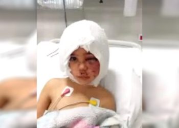 Pitbull saldırısı sonrası doku nakli yapılan Asiye uyandırıldı