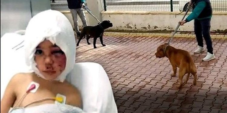 Pitbull saldırısına uğrayan Asiye’nin babasını, köpeklerin sahibi işten attı