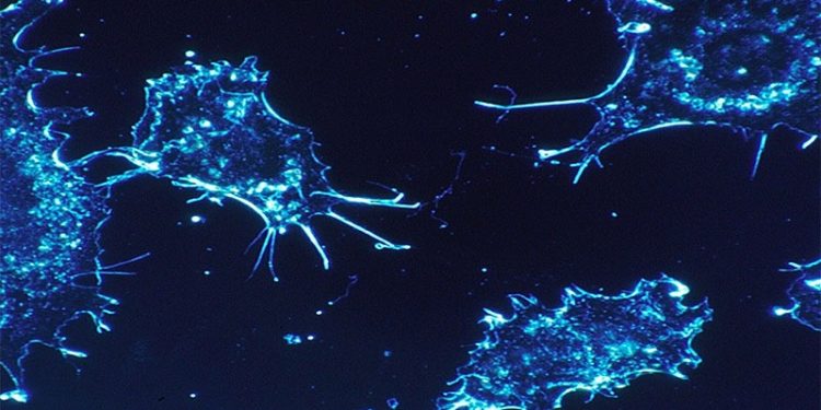 Prof. Dr. Osman Erk, kanseri tetikleyen nedenleri açıkladı