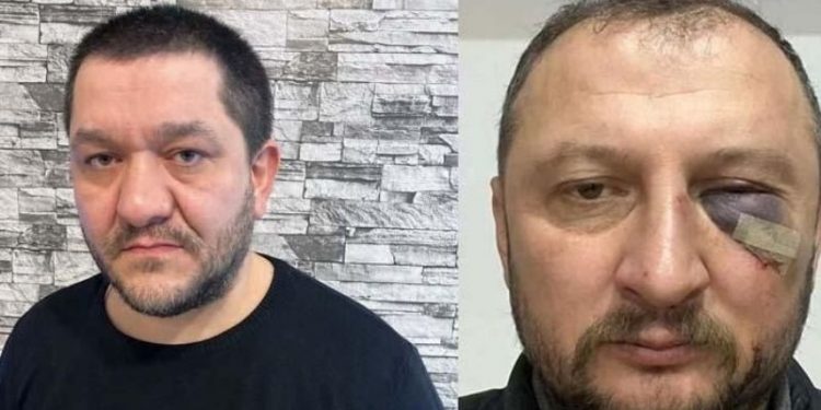 AKP'li başkanın kardeşi esnafa saldırdı