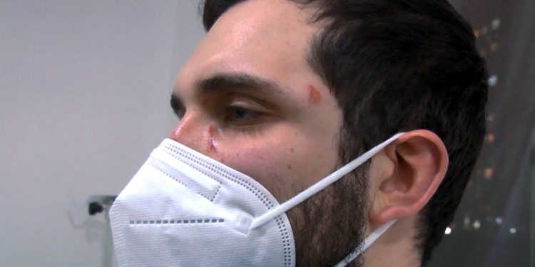 Avcılar'da bir doktor aşı nedeniyle darp edildi