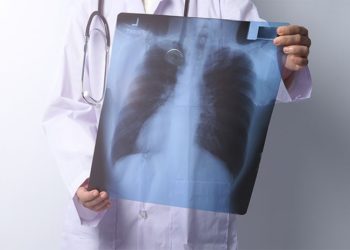 Covid-19 verem tanılarını geciktirdi