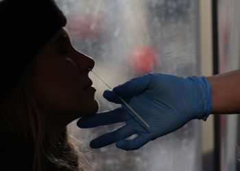 Dünya genelinde Kovid-19 vakalarının sayısı 303 milyonu geçti