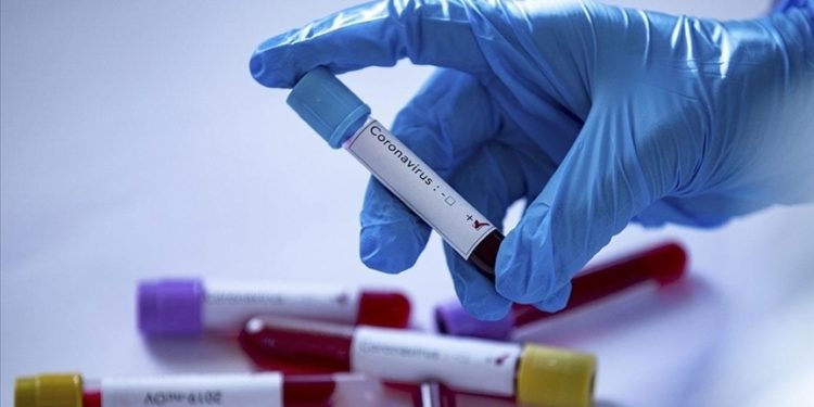 Kuzey ve Güney Kıbrıs'ta en yüksek günlük Covid-19 vaka sayıları kaydedildi