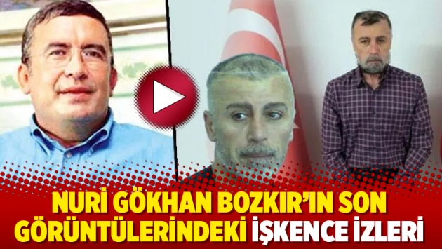 Nuri Gökhan Bozkır’ın son görüntülerindeki işkence izleri