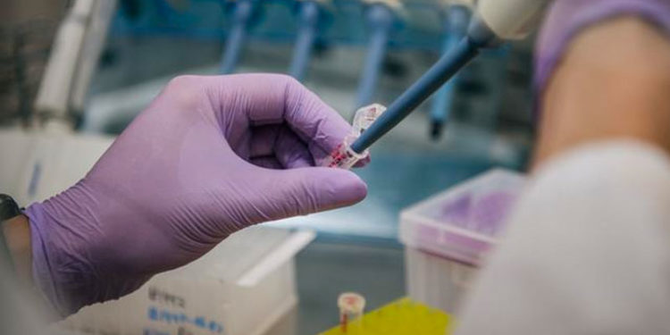 Test zorunluluğu tartışması: Hekimler ne diyor?