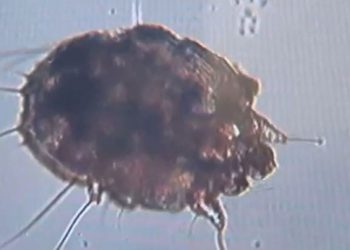 Uzman isim uyardı: Pandemide uyuz vakaları yüzde 50 arttı