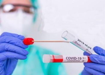 Uzmanlardan PCR kararına sert tepki: Bu, 'Omicron yayılsın, binlerce kişi ölsün'demek