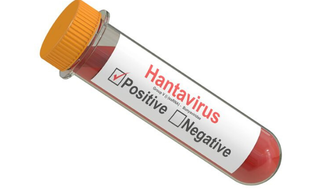 ‘Çin’de kulak ve burundan kan akıtan Hantavirüs’ haberi de yalan çıktı