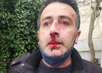 Avukatı polislerin gözü önünde darp ettiler!