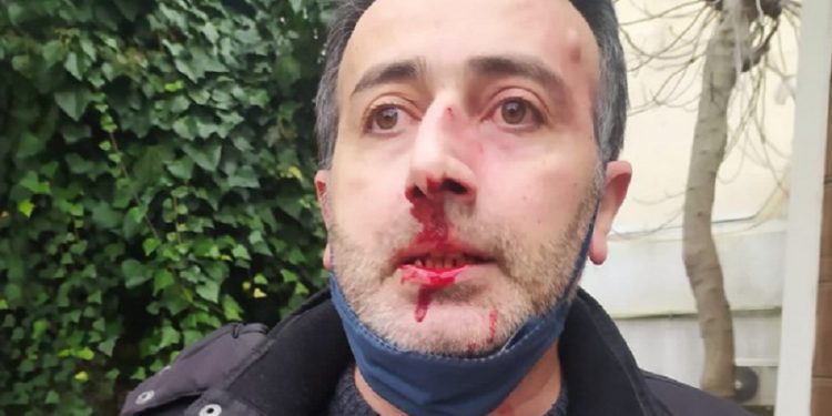 Avukatı polislerin gözü önünde darp ettiler!