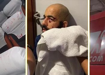 Brezilya'da Bahia otobüsüne patlayıcı madde atıldı; bazı oyuncular ciddi şekilde yaralandı!