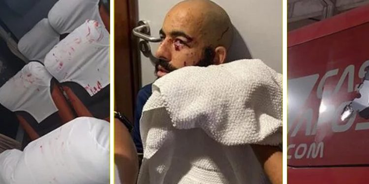 Brezilya'da Bahia otobüsüne patlayıcı madde atıldı; bazı oyuncular ciddi şekilde yaralandı!