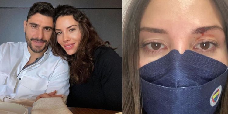 Eşine şiddet uyguladığı iddia edilen futbolcu Özer Hurmacı gözaltına alındı