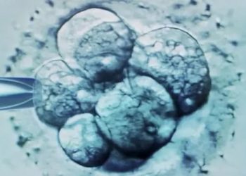 Hollanda'da doğurganlık tedavisinde kendi spermlerini kullanan doktor en az 21 çocuğun babası çıktı