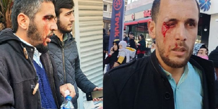 Polisten Furkan Vakfı Gönüllüleri’ne çok sert müdahale!