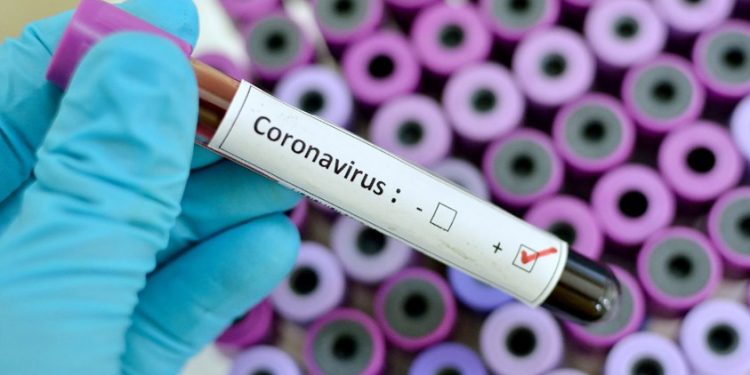 Ölümler durmuyor: Son 24 saatte 264 kişi daha hayatını kaybetti