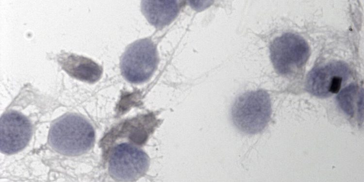 Erkekler için doğum kontrol hapı: Prezervatif ve vazektomiye alternatif olabilir