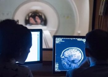 Araştırma: Covid-19 geçirenlerin beyin boyutunda küçülme gözlemlendi