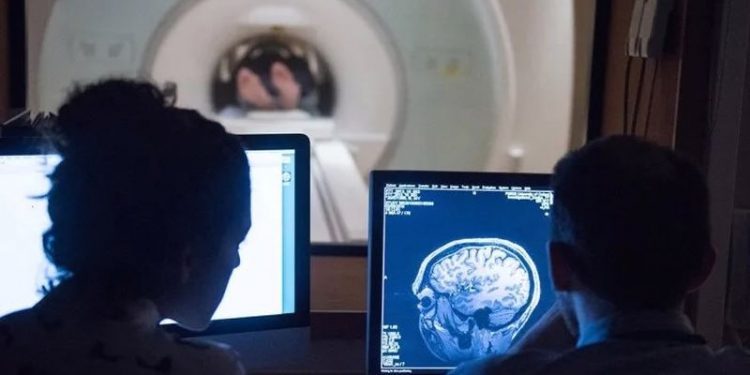 Araştırma: Covid-19 geçirenlerin beyin boyutunda küçülme gözlemlendi