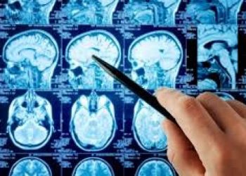 Beyin kanamasını 1 dakikada tespit eden teknoloji Cerrahpaşa'da