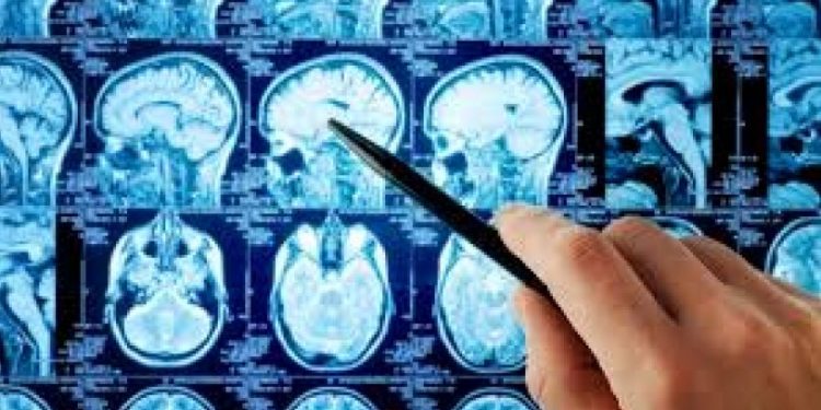 Beyin kanamasını 1 dakikada tespit eden teknoloji Cerrahpaşa'da