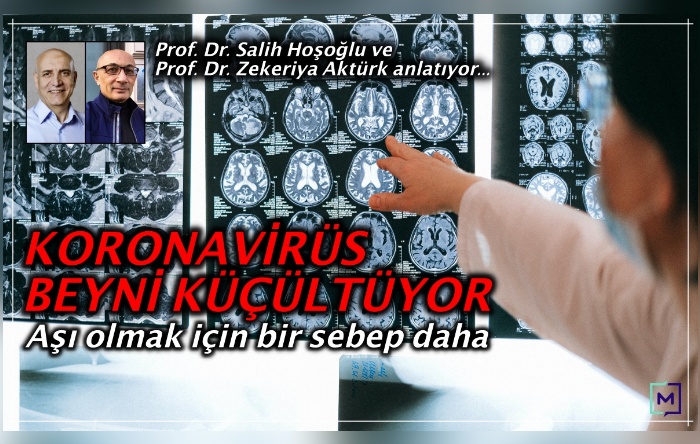 Covid-19 geçirmek beyni mi küçültüyor? Nabız’da konuşuluyor…