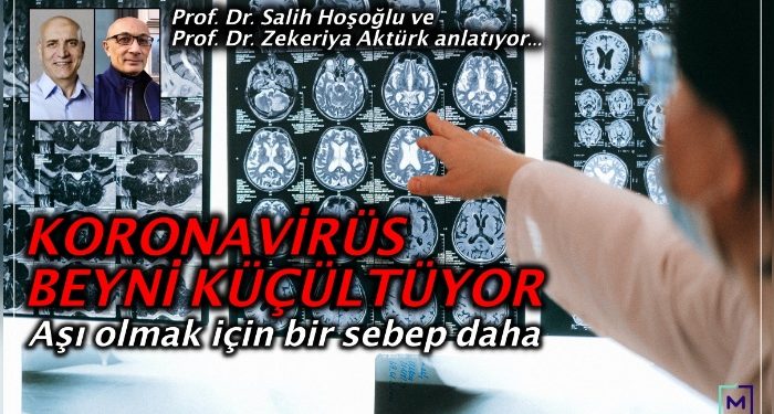 Covid-19 geçirmek beyni mi küçültüyor? Nabız’da konuşuluyor…