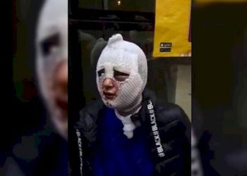 G.Ç'yi kızgın yağla yakıp 'MİT üyesiyim bana bir şey olmaz' diyen erkek tahliye edildi