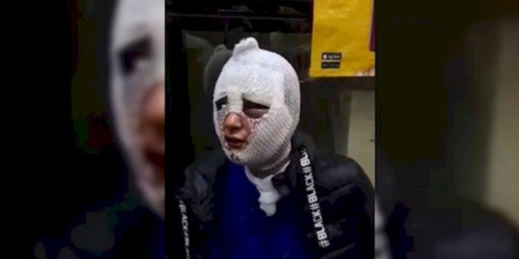 G.Ç'yi kızgın yağla yakıp 'MİT üyesiyim bana bir şey olmaz' diyen erkek tahliye edildi