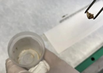 Kanser sandılar 'badem zarı' çıktı