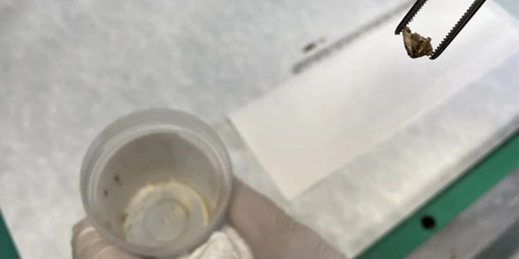 Kanser sandılar 'badem zarı' çıktı