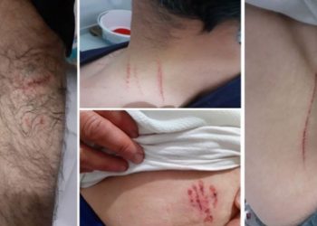 Köpekli işkencede bakanlık tazminata mahkum edildi