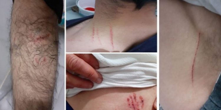 Köpekli işkencede bakanlık tazminata mahkum edildi