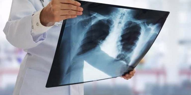 Salgında Hindistan'da verem nedeniyle ölümler on yıldan sonra ilk kez yükseldi