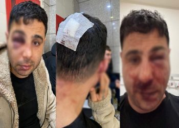 Ters kelepçe takılan kişiye polis aracında işkence!