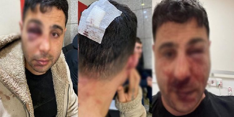 Ters kelepçe takılan kişiye polis aracında işkence!