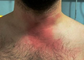 Uzman çavuştan doktora şiddet