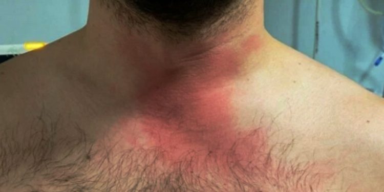 Uzman çavuştan doktora şiddet