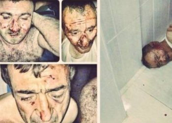 Van Valiliği’nden işkence savunması: Bir kere yapıldı, basit tedavi ile giderilebilir