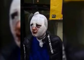 Zorla girdiği evdeki kadını istismar edip kızgın yağla yakan istihbarat muhbirine 15 dakikada tahliye!