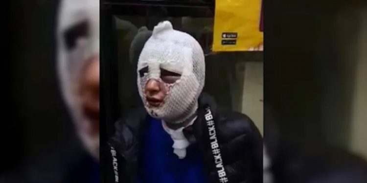 Zorla girdiği evdeki kadını istismar edip kızgın yağla yakan istihbarat muhbirine 15 dakikada tahliye!